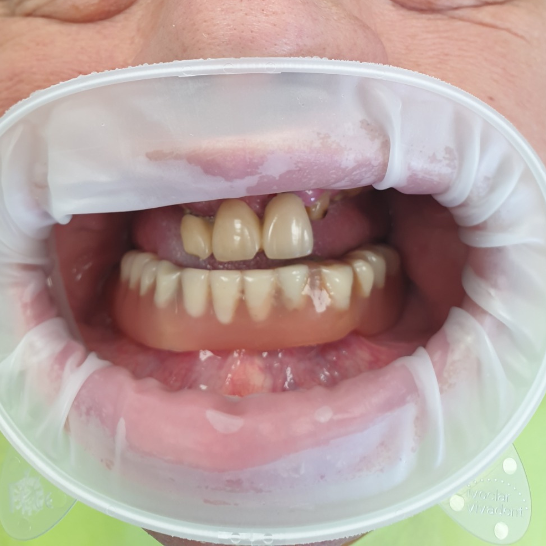 Before