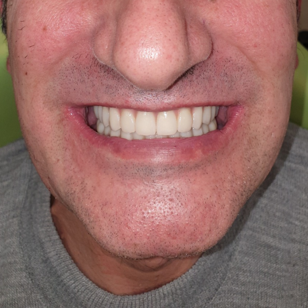After