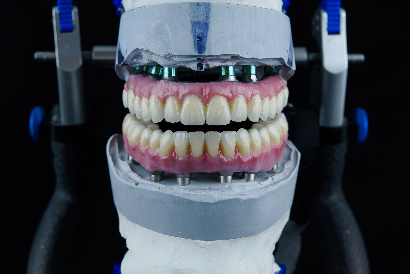 Coroane din Zirconiu - Protetică Dentară